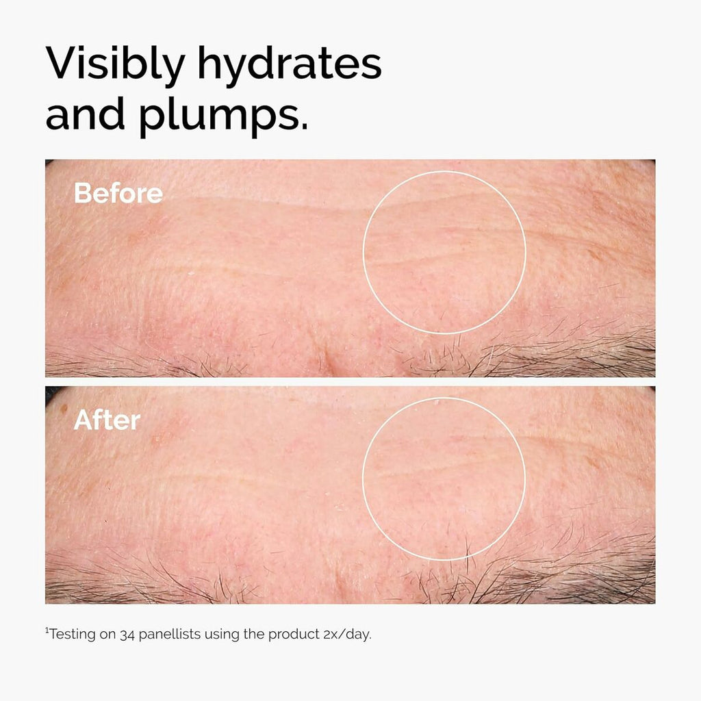 Facial Serum The Ordinary HYALURONIC ACID 2% + B5 30 ml