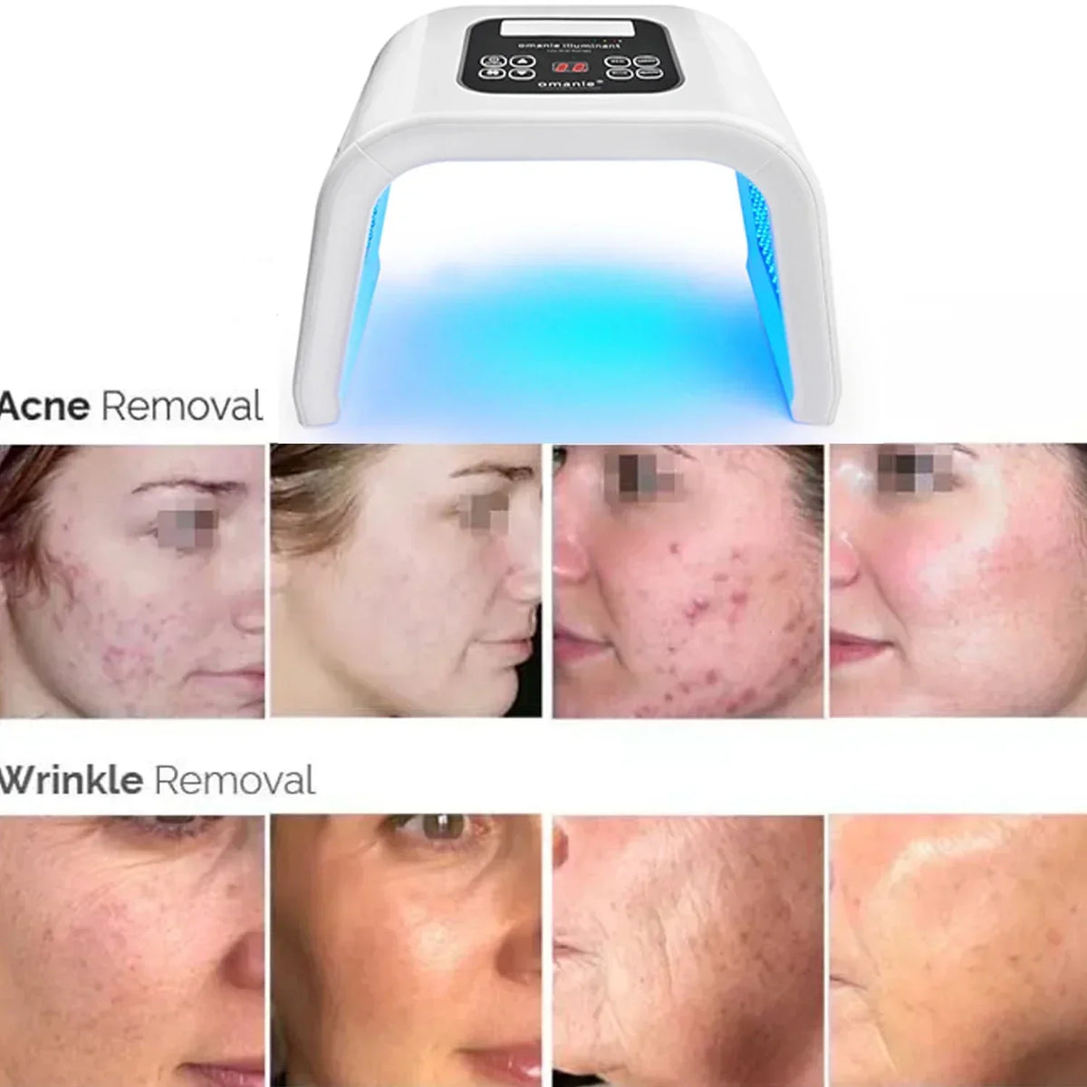 NNEOBA 7-Color LED Photon Heating Facial Mask for Home Skin Care